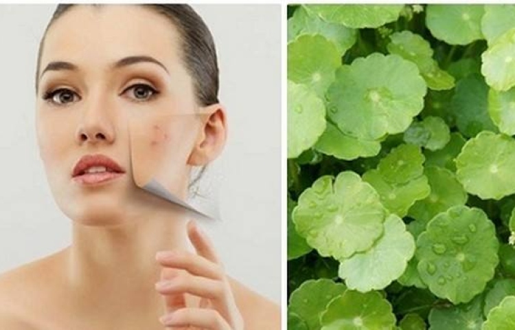 3 phương pháp chăm sóc da từ rau má