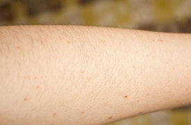 Lưu ý dành cho các nàng có ý định wax lông