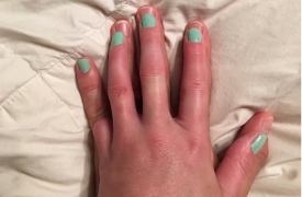 Tình yêu vợ đằng sau móng tay sơn màu suốt đời của chồng