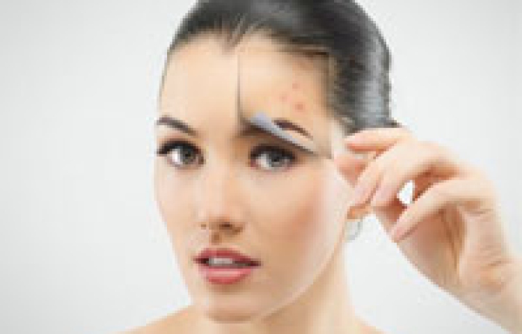 Tổng hợp cách trị sẹo trên da nhờ thực phẩm 